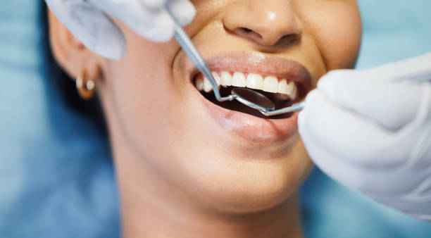 Best Emergency Root Canal Therapy in Waxhaw, NC